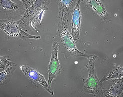 <p>When a cell is exposed to life-threatening conditions, the protein HSF1 (marked in green) initiates an emergency program to prevent permanent damage to the cell.</p>