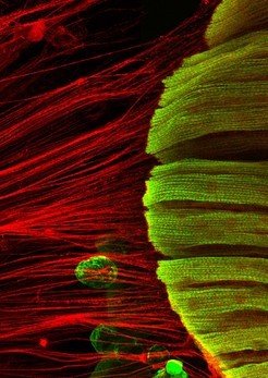 <p>When muscles (green) and tendons (red) are under tension, regular myofibrils assemble, with their sarcomeric units arrayed like pearls on a string (on the right in green).</p>