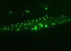 Picture: Prasad Kasturi / © MPI of Biochemistry <p>Muscle cell of a long-lived nematode worm: Chaperone-rich protein aggregates (green) accumulate and save the cell during aging.</p>