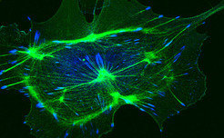 Integrins are anchor proteins that span the plasma membrane and couple the surrounding with the actin cytoskeleton. Integrins play fundamental roles in numerous important processes including cell migration, cell division and blood clotting. Reinhard Fässler and his team study how integrins execute these diverse functions and how malfunctioning integrins affect organogenesis and disease.