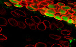 Each cell of an organism contains a complete copy of the genetic material. Depending on the cell type and the developmental status, only a fraction of it is used, the rest is inactive. But what decides which genes are used? What is the mechanism of this regulation? These are the questions Jürg Müller and his team seek to answer.