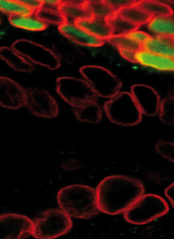 Zellen ohne das Polycomb-Protein Ph (kein grünes Markerprotein) haben eine stark veränderte Zellmorphologie und sind größer als normale Zellen (grünes Markerprotein). Zellen ohne Ph-Protein bilden Tumore in Drosophila.