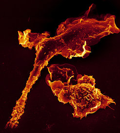 Makrophagen (orange dargestellt) locken andere Abwehrzellen über Botenstoffe zum Entzündungsherd. Copyright: Volker Brinkmann/MPI für Infektionsbiologie
