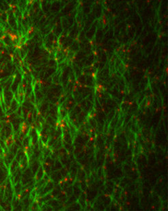 Motor protein (red) bind to actin filaments (green) - a first step to the physical division of a cell. (Picture: Sven Vogel / Copyright: MPI of Biochemistry)