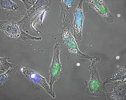 When a cell is exposed to life-threatening conditions, the protein HSF1 (marked in green) initiates an emergency program to prevent permanent damage to the cell.
