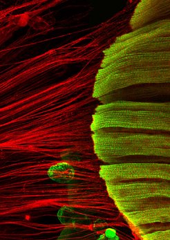 When muscles (green) and tendons (red) are under tension, regular myofibrils assemble, with their sarcomeric units arrayed like pearls on a string (on the right in green).