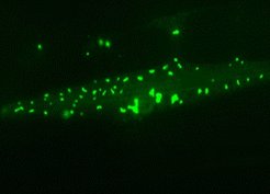 Muscle cell of a long-lived nematode worm: Chaperone-rich protein aggregates (green) accumulate and save the cell during aging.
