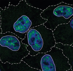 Das neu entdeckte Protein NCBP3 (grün markiert) bei der Arbeit im Zellkern (blau markiert). Die gestrichelte Linie stellt die Zellabgrenzung dar.