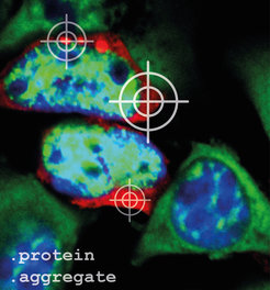 Damit Proteinaggregate (rot) in den Zellen unter dem Mikroskop sichtbar sind, müssen sie vorher angefärbt werden. Die Zellkerne wurden blau, und die mRNA, die Bauanleitung für Proteine, wurde grün angefärbt.
