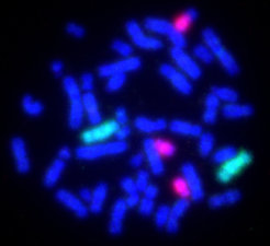 Viele Krebszellen sind aneuploid. Das heißt, sie besitzen mehr oder weniger Chromosomen als gesunde Zellen. Die veränderte Chromosomenzahl (pink) führt zu einer deutlich höheren Rate an DNA-Schäden.