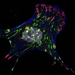 The picture shows a cell, in which the newly discovered protein Kank2 is shown in green. Integrin-based adhesions (in red) strongly anchor to the extracellular matrix at the cell edges but loose the grip in the cell center where Kank2 is present. Contractile actin cytoskeleton is shown in blue. In the center the cell nucleus is visible.