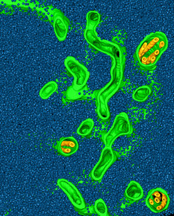 This image depicts a rendering of a cryo-electron tomogram of a Chlamydomonas pyrenoid, with tubule membranes (green and yellow) awash in a “sea” of Rubisco enzymes (blue). Benjamin Engel and colleagues found that Rubisco proteins in the pyrenoid are packed together like a liquid.