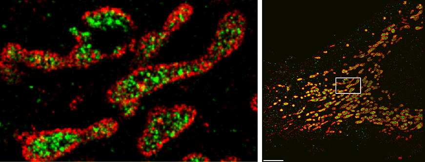 SDC-PAINT can accurately visualize the distribution of the cell’s energy-producing structures known as mitochondria by combining high-resolution fluorescence signals from a protein in their outer membranes (in red) and a protein in its interior lumen (in green). The Gif on the left shows consecutive sections taken through a cell’s 3D space at the area outlined with the small rectangle in the image on the right.