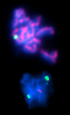 Das Bild zeigt isolierte Hefechromosomen auf denen DNA (blau), Kohäsin (rot), und ein Locus (grün) auf einem der 16 Chromosomen angefärbt wurden. Oben: normale Zelle, in der das Kohäsin die Chromosomenpaare über ihre gesamte Länge zusammenhält. Unten: mutierte Zelle, in der das Kohäsin zu früh zerstört worden ist und die Chromosomenpaare auseinanderfallen.