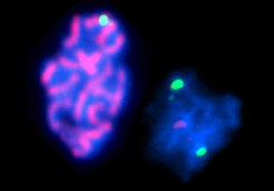 Surface-spread chromatin from a wild-type (left) and a mnd2 mutant cell (right). Blue, DNA; red, cohesin; geen, one of the two chromosome V homologs marked with green flourescent protein.