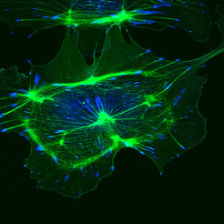 Hair follicles in the mouse tail skin: cell nuclei of the epidermis (blue) and three hair follicles with sebaceous glands. Integrins (red) and a focal adhesion protein (green) are essential for their development.