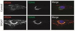 Figure 2: ATG9A trafficking is perturbed in fibroblasts from patients with mutations in AP-4 (shown here for the AP-4 beta subunit/SPG47). In the AP-4 mutant, ATG9A accumulates at the TGN, as evidenced by extensive co-localization with the marker protein TGN46.