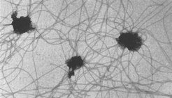 Fig. 1: Flagellated polar caps. Taken from Kupper et al., 2001