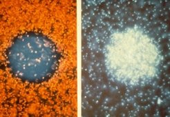 Light trap experiments with Halobacterium salinarum. Left: cells escape from a central spot of blue light. Right: cells accumulate in a central spot of orange light (false color representation). (from Stoeckenius et al. 1988))