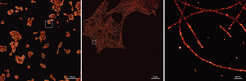 Super-resolved DNA-PAINT allows the detection of the ultrastructure of cells, such as microtubules, which are part of the cytoskeleton.