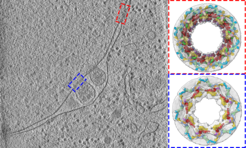 Cryo-tomographic slice of a S. cerevisiae cell missing the protein Nup116 kept for 4 hours at the non-permissive temperature of 37°C. Dotted rectangles mark the positions subjected to structural analysis; on the right cryo-EM maps (gray) with fitted the respective integrative models (colored).