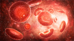 A mutation in the JAK2-Pathway can lead to myeloproliferative neoplasias (MPN), an overproduction of blood cells.