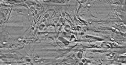 Cryo-focussed ion beam instruments are the state of the art in sample preparation to produce thin cellular slices for cry-electron tomography.