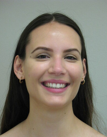 Ana Perovic