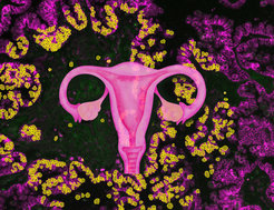 The picture shows a schematic representation of an ovary in the foreground. In the background is a tissue section stained with fluorescent dye.